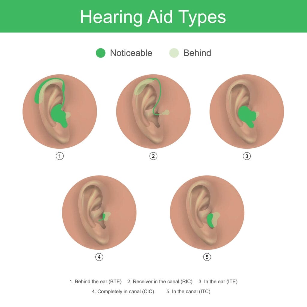 An illustrated chart showing five different types of hearing aids: behind the ear (BTE), receiver in the canal (RIC), in the ear (ITE), completely in canal (CIC), and in the canal (ITC).